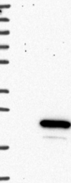 NBP1-80888 - AVP-induced protein 1