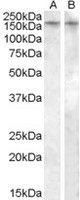 NB100-96917 - Vasopressin V1b receptor (V1bR)