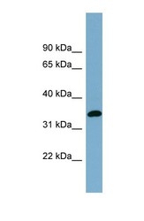NBP1-59865 - DGAT2L3 / AWAT1
