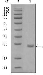 NBP1-47351 - AXL / UFO