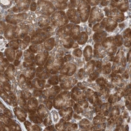 NBP1-85785 - AUP1