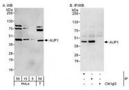 NBP1-49916 - AUP1