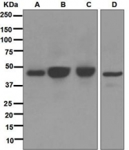NBP1-95194 - Type-1 angiotensin II receptor (AT1)