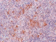 NBP1-77078 - Type-1 angiotensin II receptor (AT1)