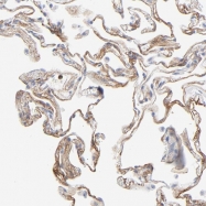 NBP1-90212 - Type-1 angiotensin II receptor (AT1)