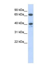NBP1-59006 - Type-1 angiotensin II receptor (AT1)