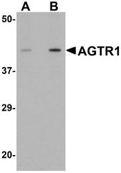 NBP1-77078 - Type-1 angiotensin II receptor (AT1)