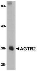 NBP1-77368 - Type-2 angiotensin II receptor (AT2)