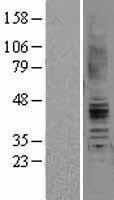 NBL1-07397 - Angiotensin II Type 2 Receptor Lysate