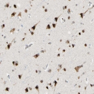 NBP1-90065 - Ataxin-1