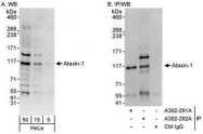 NBP1-28734 - Ataxin-1