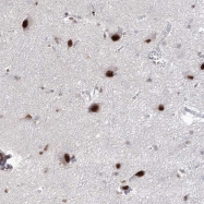 NBP1-90044 - Atrophin-1