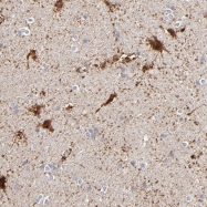 NBP1-90103 - Aurora kinase A