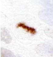 NB500-185 - Aurora kinase B