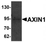 NBP1-76483 - Axin-1