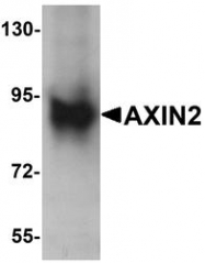 NBP1-76526 - Axin-2
