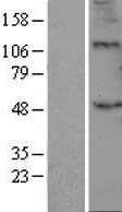 NBL1-07877 - B3GALT2 Lysate