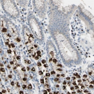 NBP1-88653 - B4GALT3