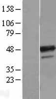 NBL1-07889 - B4GALT3 Lysate