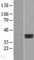 NBL1-07891 - B4GALT7 Lysate