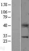NBL1-17768 - B7H4 Lysate