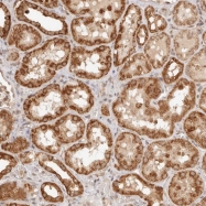 NBP1-89443 - BAALC