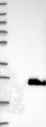 NBP1-89443 - BAALC