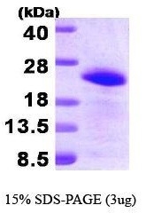 NBP1-30302 - BAALC