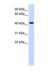 NBP1-62416 - BACE1