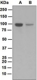 NBP1-95166 - BACH1