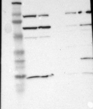 NBP1-88722 - BACH1