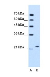 NBP1-59087 - BAG2