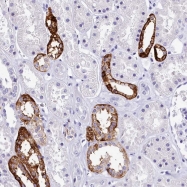 NBP1-81457 - BAHD1