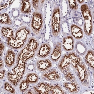 NBP1-81458 - BAHD1