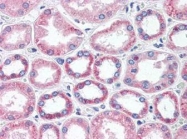 NBP1-50518 - BAI3