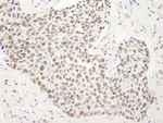 NB100-79784 - BANP / SMAR1