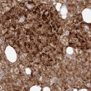 NBP1-85953 - BARHL2