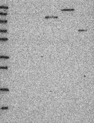 NBP1-91695 - BBS2