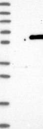 NBP1-86248 - BBS4