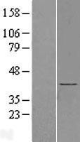 NBL1-07930 - BBS5 Lysate