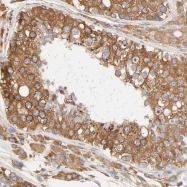 NBP1-89357 - BCAP31 / BAP31