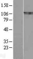 NBL1-07935 - BCAR1 Lysate