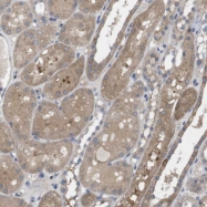NBP1-82523 - BCAR3 / SH2D3B