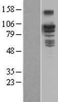 NBL1-07936 - BCAR3 Lysate