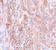 NBP1-77124 - BCAS2 / DAM1