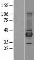 NBL1-07938 - BCAT1 Lysate