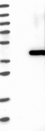NBP1-86326 - BCKDHB