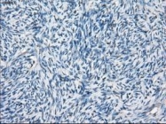 NBP1-47664 - BCKDK