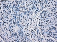 NBP1-47664 - BCKDK