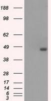 NBP1-47664 - BCKDK